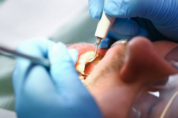 Best Urgent Tooth Repair  in Colorado City, AZ